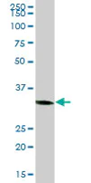 Western blot - Anti-COSMC antibody (AB68310)