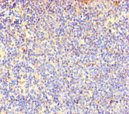 Immunohistochemistry (Formalin/PFA-fixed paraffin-embedded sections) - Anti-COTL1 antibody (AB235833)