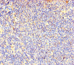Immunohistochemistry (Formalin/PFA-fixed paraffin-embedded sections) - Anti-COTL1 antibody (AB235833)