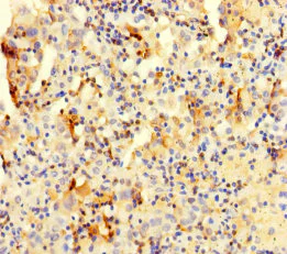 Immunohistochemistry (Formalin/PFA-fixed paraffin-embedded sections) - Anti-COTL1 antibody (AB235833)