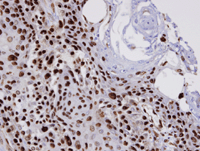 Immunohistochemistry (Formalin/PFA-fixed paraffin-embedded sections) - Anti-COUP TF1 antibody (AB96846), expandable thumbnail