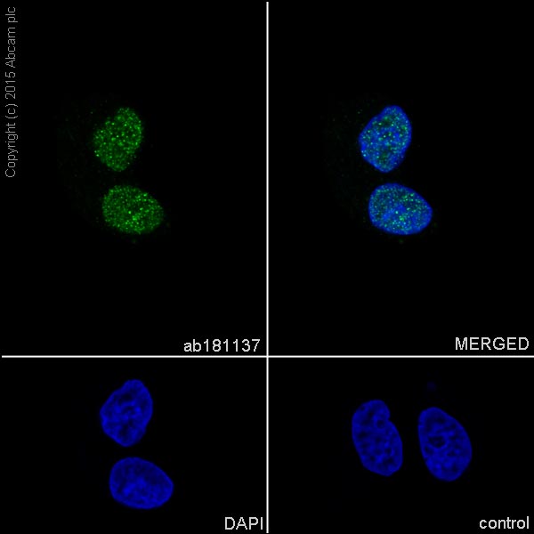 Immunocytochemistry/ Immunofluorescence - Anti-COUP TF1 antibody [EPR10841] (ab181137), expandable thumbnail