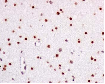 Immunohistochemistry (Formalin/PFA-fixed paraffin-embedded sections) - Anti-COUP TF1 antibody [EPR10841] (ab181137), expandable thumbnail