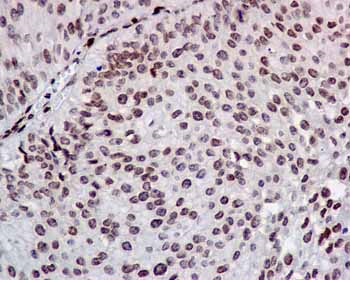 Immunohistochemistry (Formalin/PFA-fixed paraffin-embedded sections) - Anti-COUP TF1 antibody [EPR10841] (ab181137), expandable thumbnail