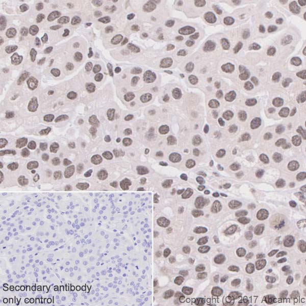 Immunohistochemistry (Formalin/PFA-fixed paraffin-embedded sections) - Anti-COUP TF1 antibody [EPR10841] (AB181137), expandable thumbnail
