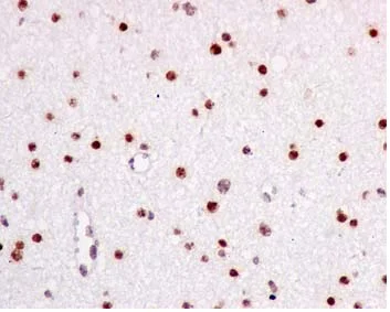 Immunohistochemistry (Formalin/PFA-fixed paraffin-embedded sections) - Anti-COUP TF1 antibody [EPR10841] - BSA and Azide free (AB224272)