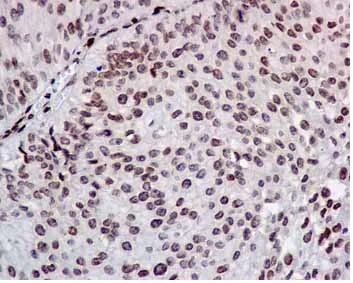 Immunohistochemistry (Formalin/PFA-fixed paraffin-embedded sections) - Anti-COUP TF1 antibody [EPR10841] - BSA and Azide free (AB224272)