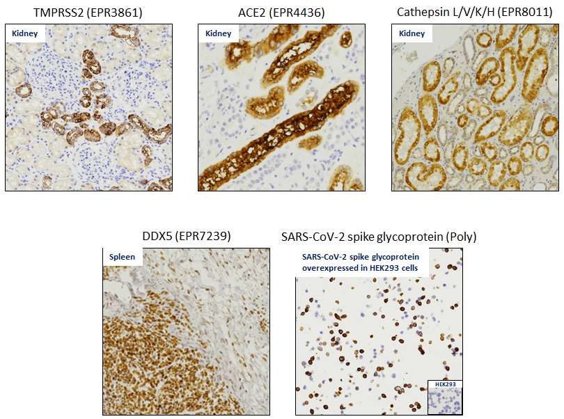 Immunohistochemistry (Formalin/PFA-fixed paraffin-embedded sections) - Covid-19 GeoMx-formatted Antibody Panel (AB273594), expandable thumbnail