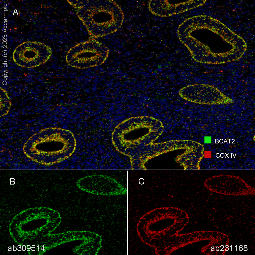 Multiplex immunohistochemistry - Anti-COX IV antibody [EPR9442(ABC)] - BSA and Azide free - Mitochondrial Marker (ab231168), expandable thumbnail