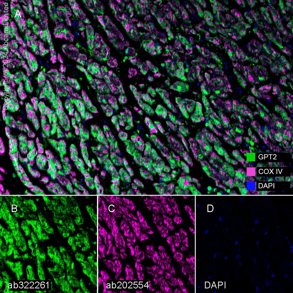 Multiplex immunohistochemistry - Anti-COX IV antibody [EPR9442(ABC)] - BSA and Azide free - Mitochondrial Marker (ab231168), expandable thumbnail
