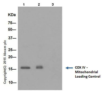 Immunoprecipitation - Anti-COX IV antibody [EPR9442(ABC)] - Mitochondrial Loading Control (AB202554)
