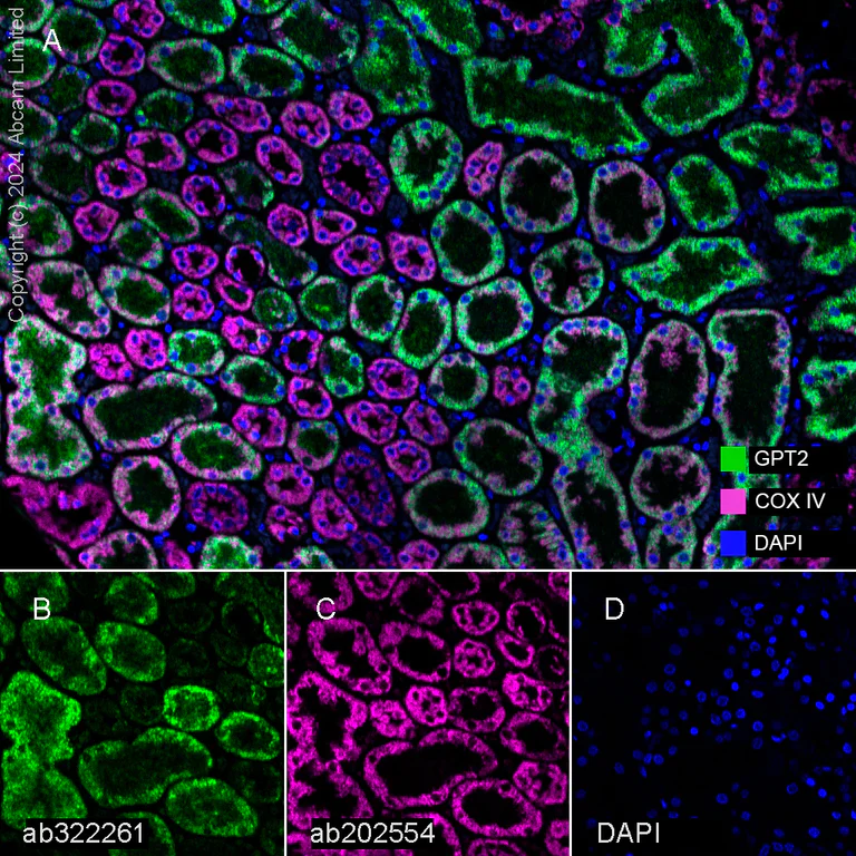 Multiplex immunohistochemistry - Anti-COX IV antibody [EPR9442(ABC)] - Mitochondrial Loading Control (AB202554)