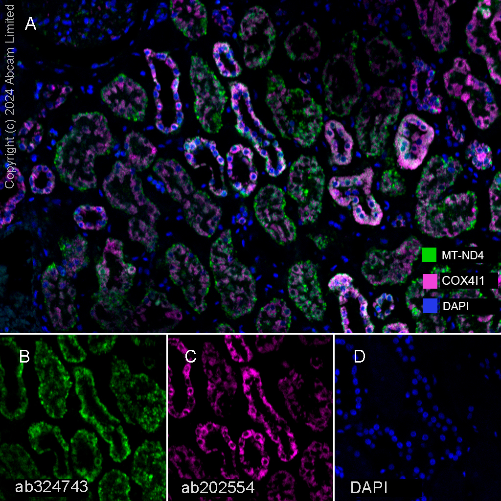 Multiplex immunohistochemistry - Anti-COX IV antibody [EPR9442(ABC)] - Mitochondrial Loading Control (AB202554)