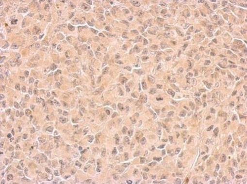 Immunohistochemistry (Formalin/PFA-fixed paraffin-embedded sections) - Anti-COX1 / Cyclooxygenase 1 antibody (AB227513), expandable thumbnail