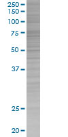 COX1 / Cyclooxygenase 1 overexpression 293T lysate (whole cell)