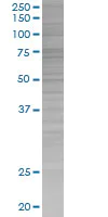SDS-PAGE - COX1 / Cyclooxygenase 1 overexpression 293T lysate (whole cell) (AB94213)