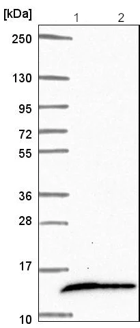 Western blot - Anti-COX16 antibody (AB190251)