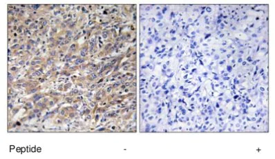 Immunohistochemistry (Formalin/PFA-fixed paraffin-embedded sections) - Anti-COX17 antibody (AB69611)