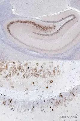 Immunohistochemistry (Formalin/PFA-fixed paraffin-embedded sections) - Anti-COX2 / Cyclooxygenase 2 antibody (AB15191)