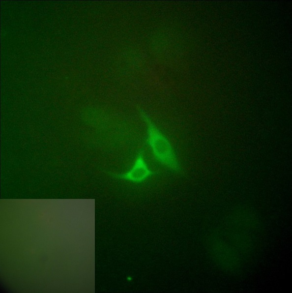 Immunocytochemistry/ Immunofluorescence - Anti-COX2 / Cyclooxygenase 2 antibody (AB52237), expandable thumbnail