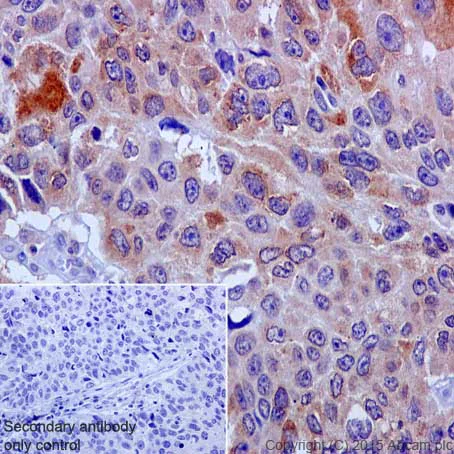 Immunohistochemistry (Formalin/PFA-fixed paraffin-embedded sections) - Anti-COX2 / Cyclooxygenase 2 antibody [EPR12012] - BSA and Azide free (AB227528)