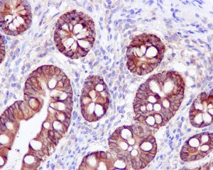 Immunohistochemistry (Formalin/PFA-fixed paraffin-embedded sections) - Anti-COX2 / Cyclooxygenase 2 antibody [EPR12012] - BSA and Azide free (AB227528)