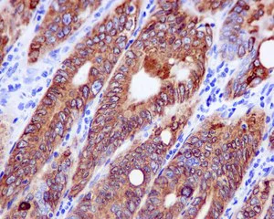 Immunohistochemistry (Formalin/PFA-fixed paraffin-embedded sections) - Anti-COX2 / Cyclooxygenase 2 antibody [EPR12012] - BSA and Azide free (AB227528)