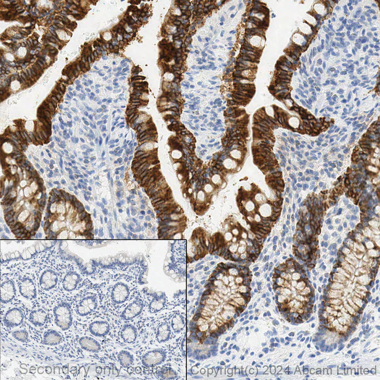 Immunohistochemistry (Formalin/PFA-fixed paraffin-embedded sections) - Anti-COX2 / Cyclooxygenase 2 antibody [EPR12012] - BSA and Azide free (AB227528)
