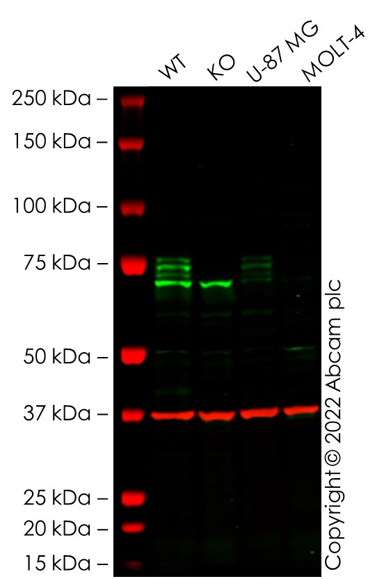 Western blot - Anti-COX2 / Cyclooxygenase 2 antibody [EPR18377-106] - N-terminal (AB188183), expandable thumbnail