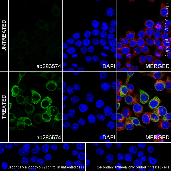 Immunocytochemistry/ Immunofluorescence - Anti-COX2 / Cyclooxygenase 2 antibody [RM1026] (ab283574), expandable thumbnail