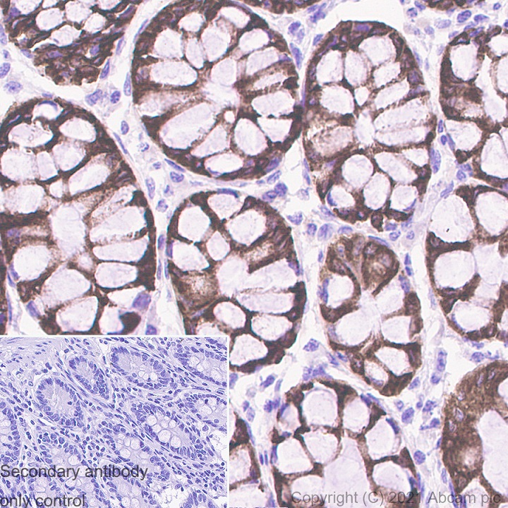 Immunohistochemistry (Formalin/PFA-fixed paraffin-embedded sections) - Anti-COX2 / Cyclooxygenase 2 antibody [RM1026] (AB283574), expandable thumbnail