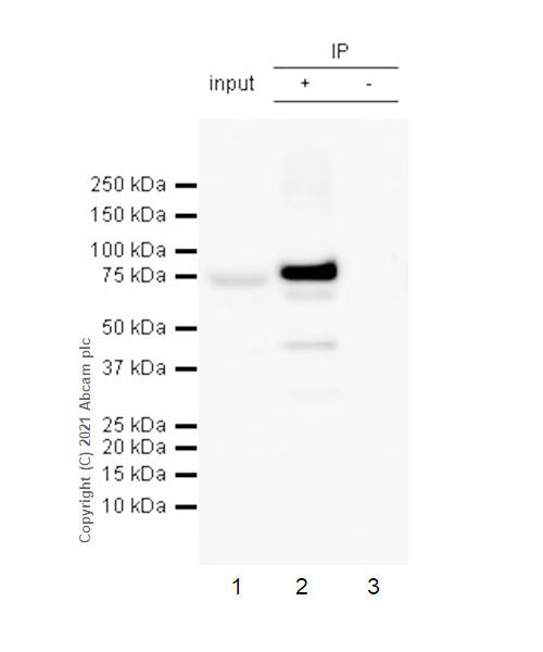 Immunoprecipitation - Anti-COX2 / Cyclooxygenase 2 antibody [RM1026] (ab283574), expandable thumbnail