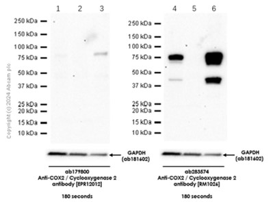 Western blot - Anti-COX2 / Cyclooxygenase 2 antibody [RM1026] (ab283574), expandable thumbnail