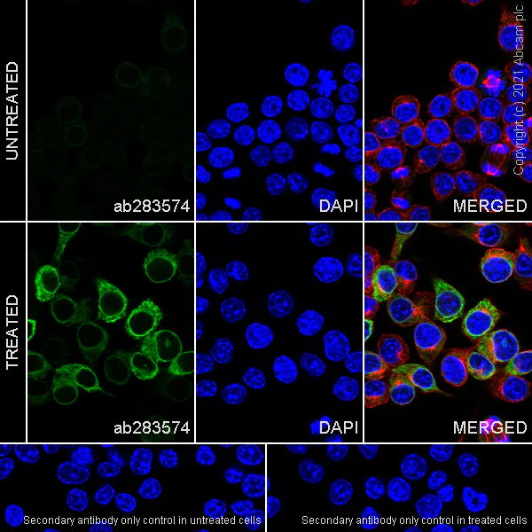 Immunocytochemistry/ Immunofluorescence - Anti-COX2 / Cyclooxygenase 2 antibody [RM1026] - BSA and Azide free (AB283593)