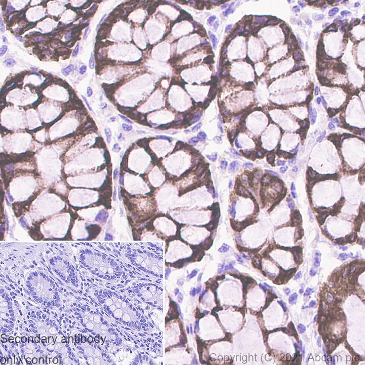 Immunohistochemistry (Formalin/PFA-fixed paraffin-embedded sections) - Anti-COX2 / Cyclooxygenase 2 antibody [RM1026] - BSA and Azide free (AB283593)