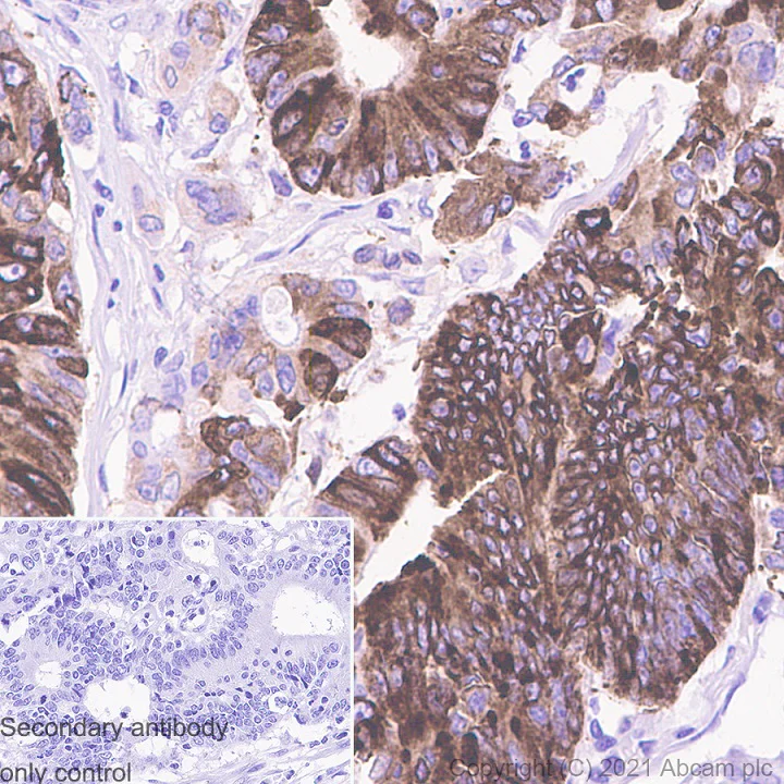 Immunohistochemistry (Formalin/PFA-fixed paraffin-embedded sections) - Anti-COX2 / Cyclooxygenase 2 antibody [RM1026] - BSA and Azide free (AB283593)