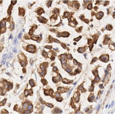 Immunohistochemistry (Formalin/PFA-fixed paraffin-embedded sections) - Anti-COX2 / Cyclooxygenase 2 antibody [SP21] (AB16701)