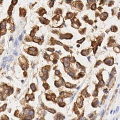 Immunohistochemistry (Formalin/PFA-fixed paraffin-embedded sections) - Anti-COX2 / Cyclooxygenase 2 antibody [SP21] - BSA and Azide free (AB307742)