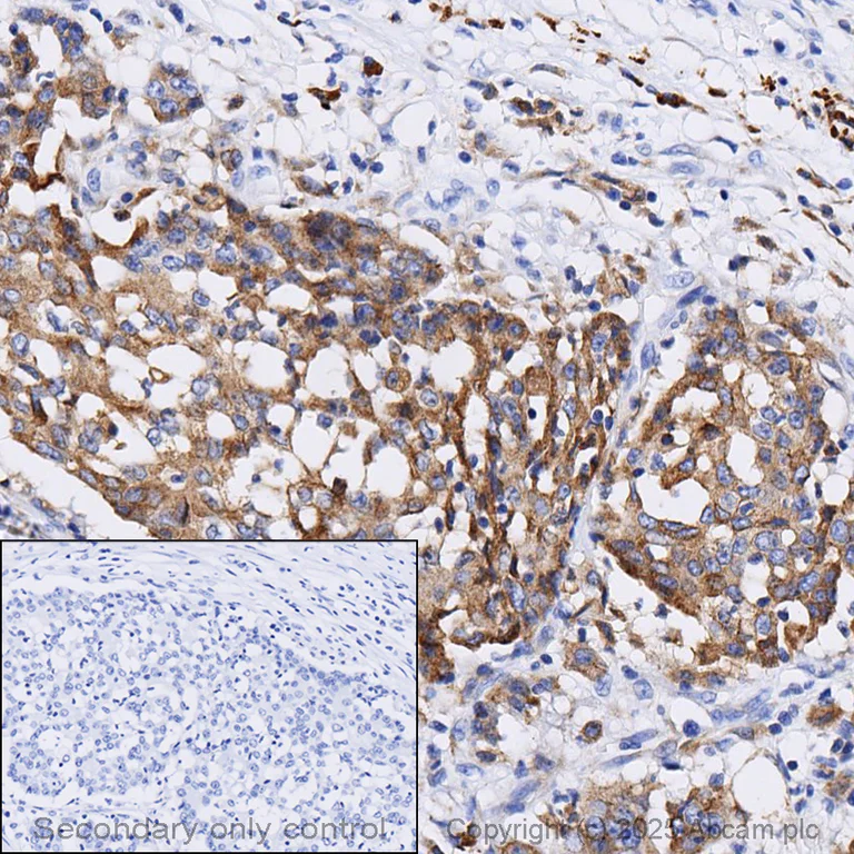 Immunohistochemistry (Formalin/PFA-fixed paraffin-embedded sections) - Anti-COX2 / Cyclooxygenase 2 antibody [SP21] - BSA and Azide free (AB307742)