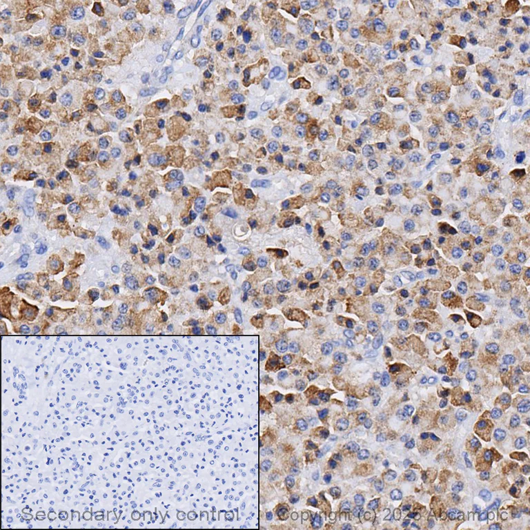 Immunohistochemistry (Formalin/PFA-fixed paraffin-embedded sections) - Anti-COX2 / Cyclooxygenase 2 antibody [SP21] - BSA and Azide free (AB307742)