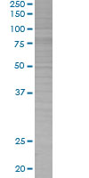 COX2 / Cyclooxygenase 2 overexpression 293T lysate (whole cell)