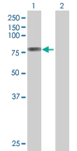Western blot - COX2 / Cyclooxygenase 2 overexpression 293T lysate (whole cell) (AB94069)