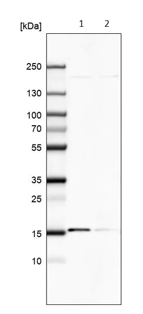 Western blot - Anti-COX20 antibody - C-terminal (AB224570)