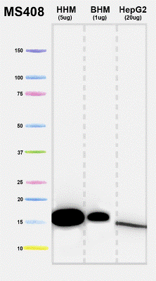 Western blot - Anti-COX4 + COX4L2 antibody [10G8D12C12] - Mitochondrial Marker (AB110261), expandable thumbnail