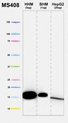 Western blot - Anti-COX4 + COX4L2 antibody [10G8D12C12] - Mitochondrial Marker (AB110261)