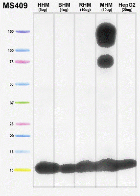 Western blot - Anti-COX5A antibody [6E9B12D5] (AB110262), expandable thumbnail