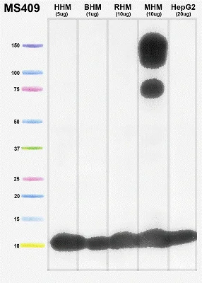 Western blot - Anti-COX5A antibody [6E9B12D5] (AB110262)