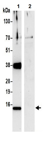 Immunoprecipitation - Anti-COX5B antibody (AB240700)