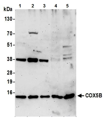 Western blot - Anti-COX5B antibody (AB240700)