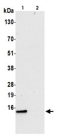 Immunoprecipitation - Anti-COX5B antibody (AB264401)